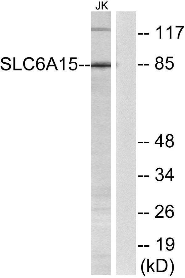 Western blot analysis of lysates from Jurkat cells, using SLC6A15 Antibody
