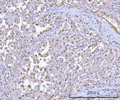  IHC analysis of PSMA1 using anti-PSMA1 antibody (A07591-1)
