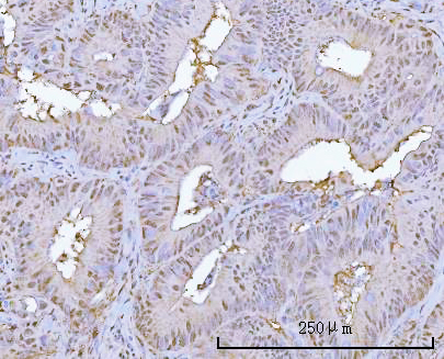  IHC analysis of PSMA1 using anti-PSMA1 antibody (A07591-1)