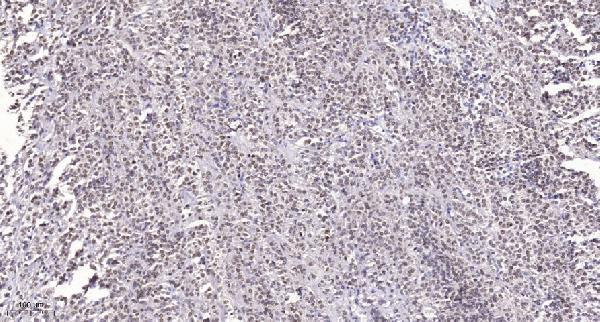 a07592 srrm2 primary antibodies ihc testing 1