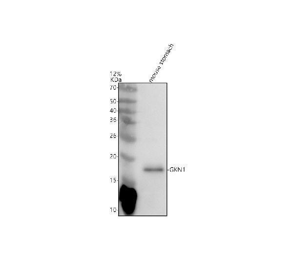 Western blot analysis of GKN1 using anti-GKN1 antibody (A07594)