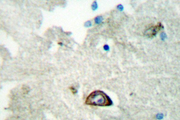 Immunohistochemistry (IHC) analyzes of Ephrin-A3 (E196) pAb in paraffin-embedded human brain tissue