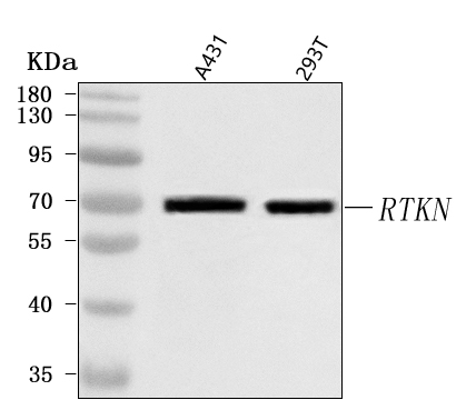  Western blot analysis of RTKN using anti-RTKN antibody (A07596-2)