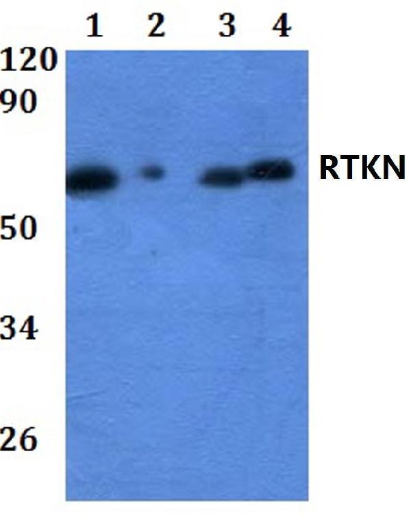 a07596 rtkn primary antiboties wb testing 1
