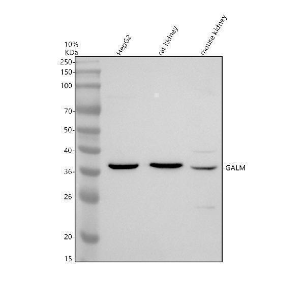 Western blot analysis of GALM using anti-GALM antibody (A07597-2)