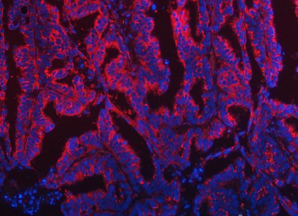 a07598 2 tom1l1 primary antibodies if testing 10