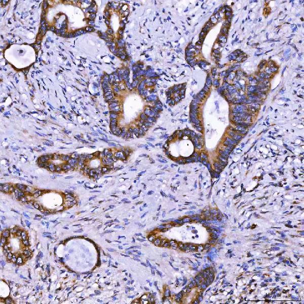  IHC analysis of TOM1L1 using anti-TOM1L1 antibody (A07598-2)