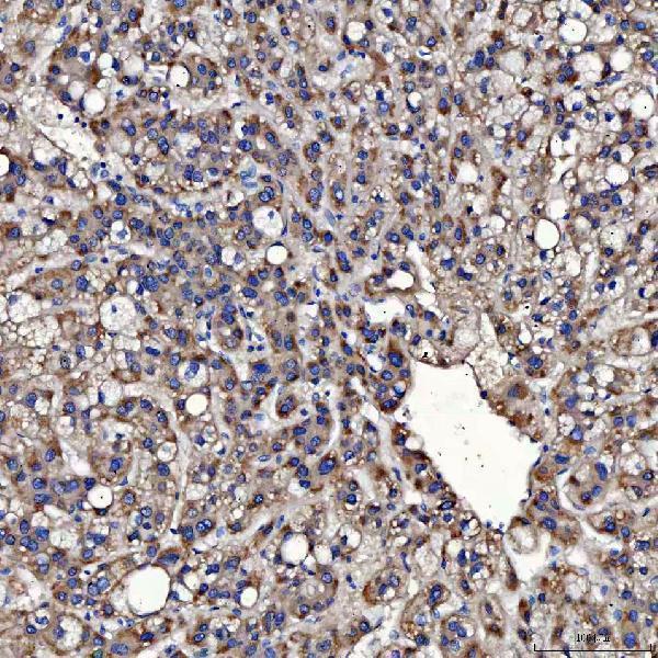  IHC analysis of TOM1L1 using anti-TOM1L1 antibody (A07598-2)