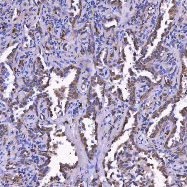a07598 2 tom1l1 primary antibodies ihc testing 4