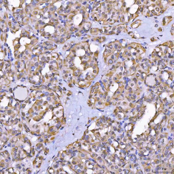 a07598 2 tom1l1 primary antibodies ihc testing 5
