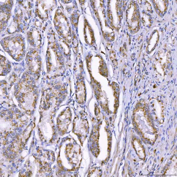 a07598 2 tom1l1 primary antibodies ihc testing 6