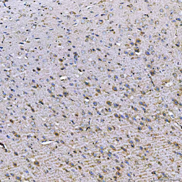 a07598 2 tom1l1 primary antibodies ihc testing 8