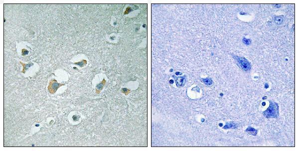 a07599t312 map3k9 primary antibodies ihc testing 2