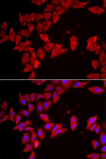 Immunofluorescence analysis of HeLa cells using SLC35A2 antibody 