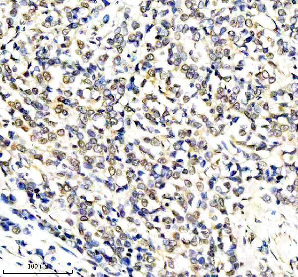  IHC analysis of RERE using anti-RERE antibody (A07605-1)