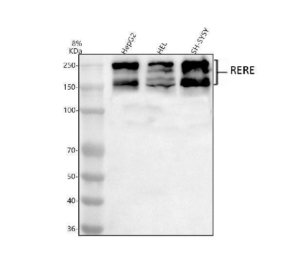  Western blot analysis of RERE using anti-RERE antibody (A07605-1)