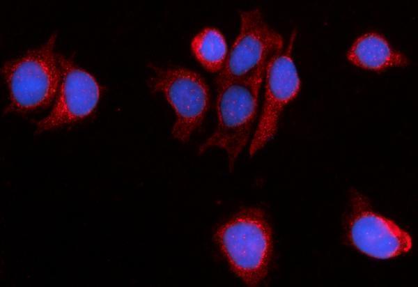 a07608 1 pde4dip primary antibodies if testing 4