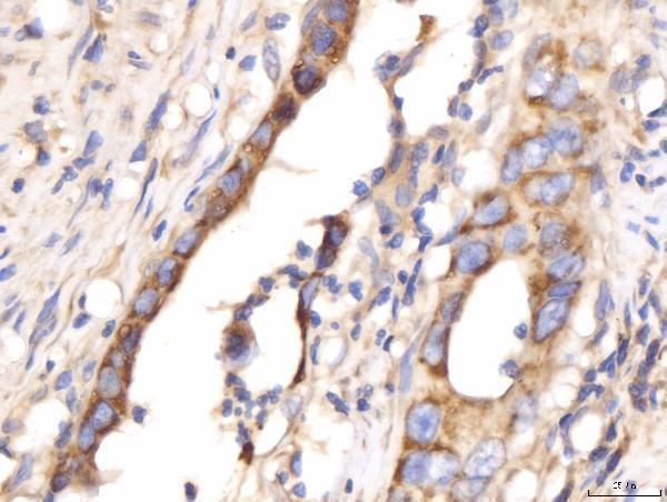  IHC analysis of PDE4DIP using anti-PDE4DIP antibody (A07608-1)