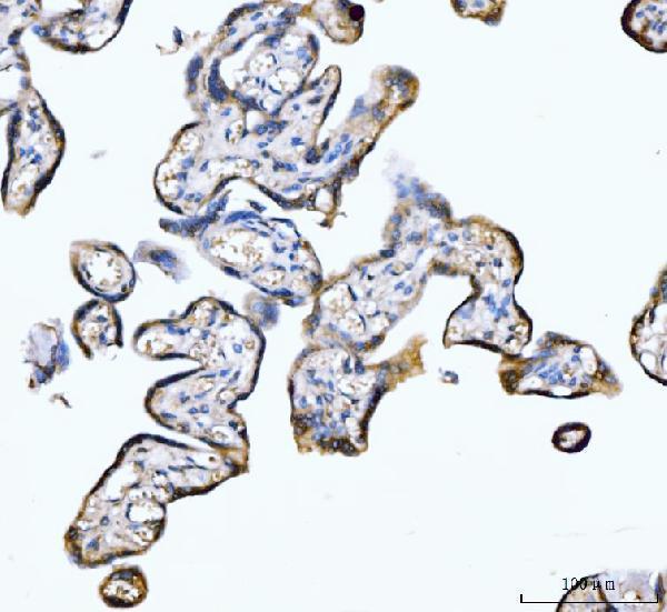  IHC analysis of PDE4DIP using anti-PDE4DIP antibody (A07608-1)