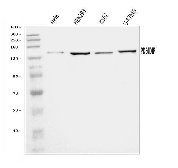  Western blot analysis of PDE4DIP using anti-PDE4DIP antibody (A07608-1)