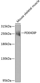 a07608 pde4dip primary antiboties wb testing 1