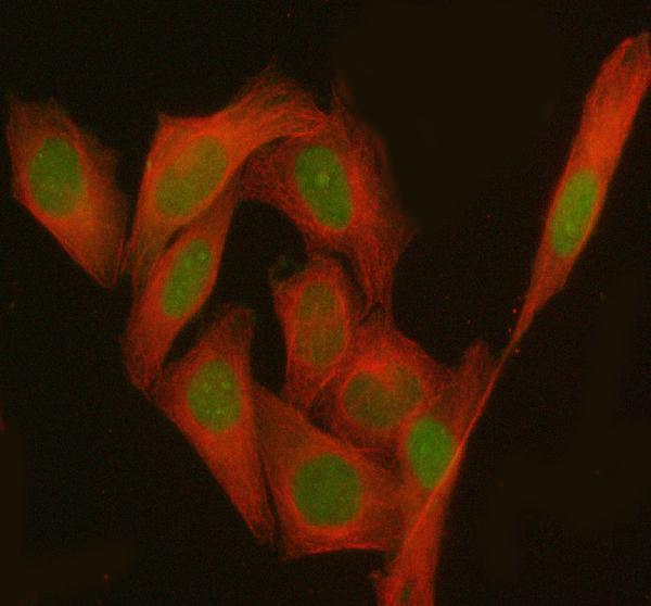  IF analysis of PHF17/JADE1 using anti-PHF17/JADE1 antibody (A07611-1) and anti-Beta Tubulin antibody (M01857-3)