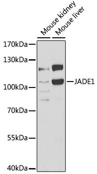 WesternBlot (WB) analysis of PHF17 polyclonal antibody