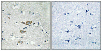 Immunohistochemistry validation of RPL12 using Anti-Ribosomal Protein L12 RPL12 Antibody (A07613-3)