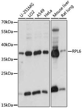 Western blot analysis of extracts of various cell lines, using RPL6 antibody  at 1:1000 dilution