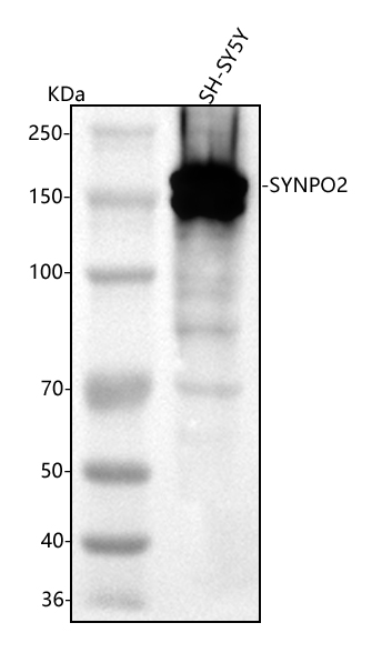 Western blot analysis of SYNPO2 using anti-SYNPO2 antibody (A07616-1)