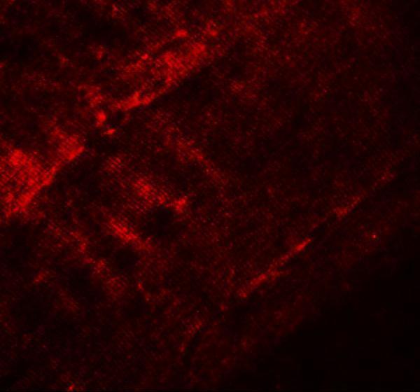 Immunofluorescence of SYNPO2 in mouse skeletal muscle tissue with SYNPO2 antibody at 20 μg/mL