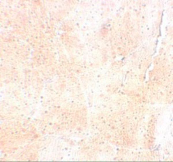 Immunohistochemistry of SYNPO2 in mouse skeletal muscle tissue with SYNPO2 antibody at 5 μg/mL