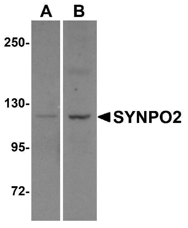 Western blot analysis of SYNPO2 in human skeletal muscle tissue lysate with SYNPO2 antibody at 1 μg/mL in (A) the absence and (B) the presence of blocking peptide