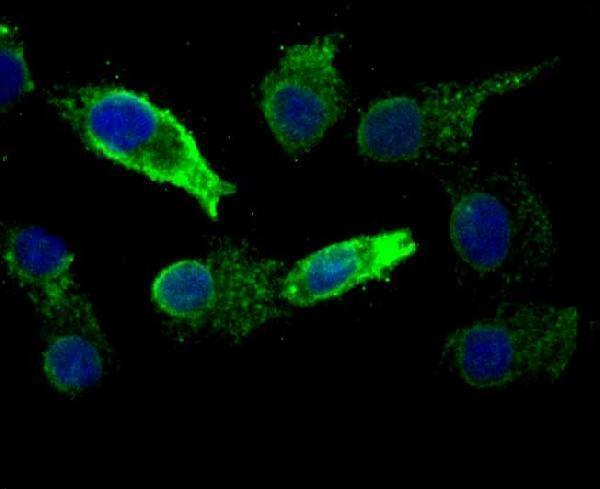 a07617 kdelr1 primary antiboties icc testing 2