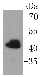a07620 1 fntb primary antiboties wb testing 1