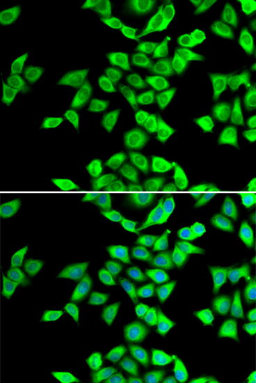 Immunofluorescence analysis of U20S cell using NMT2 antibody