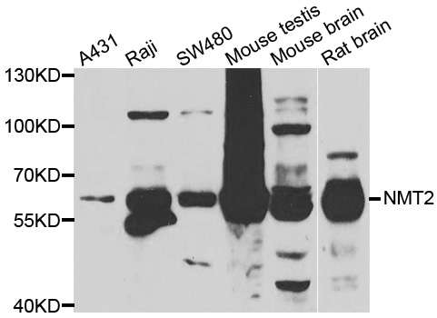 Western blot analysis of extracts of various cell lines, using NMT2 antibody