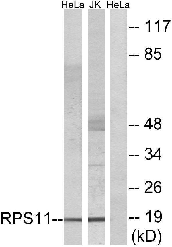 Western blot analysis of lysates from HeLa and Jurkat cells, using RPS11 Antibody