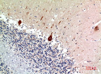 a07627 1 nodal primary antibodies ihc testing 1