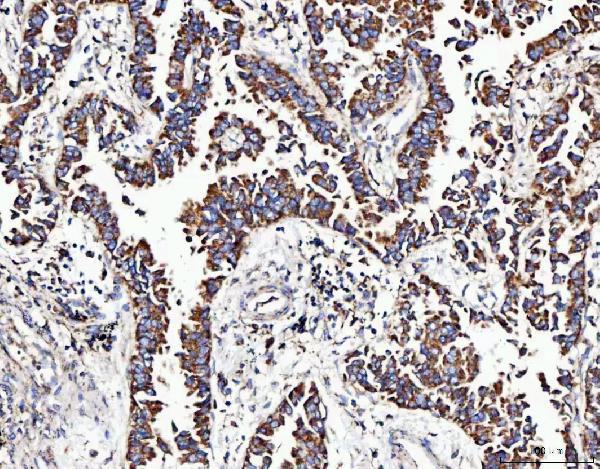 a07628 1 mocs1 primary antibodies ihc testing 2