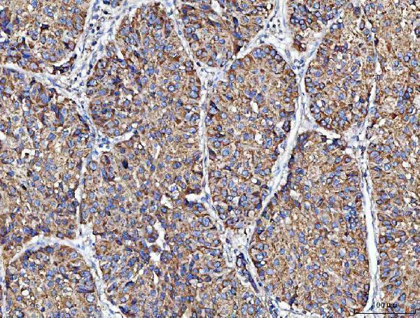 a07628 1 mocs1 primary antibodies ihc testing 4