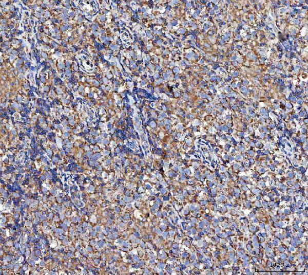 a07628 1 mocs1 primary antibodies ihc testing 5