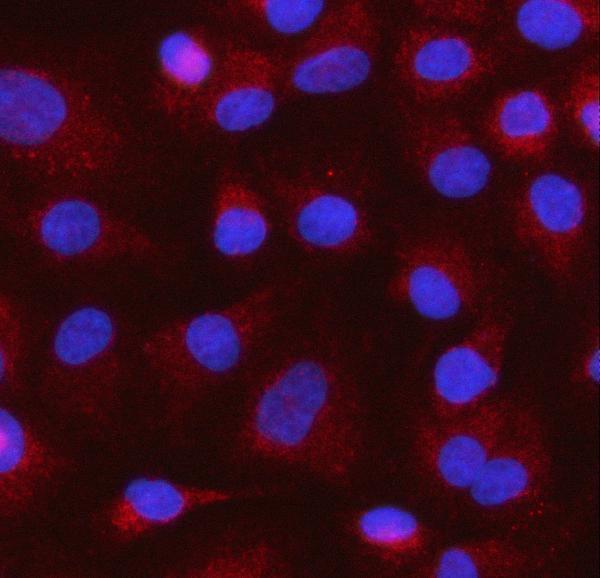 a07628 2 mocs1 primary antibodies if testing 2
