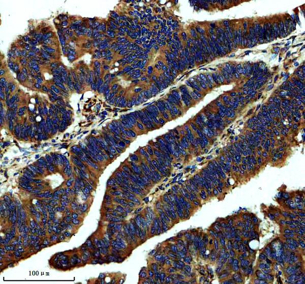 IHC analysis of LIMD1 using anti-LIMD1 antibody (A07629-1)