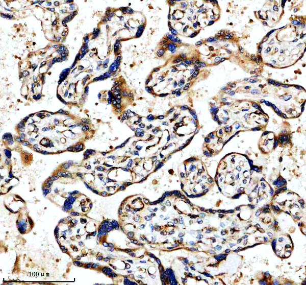 IHC analysis of LIMD1 using anti-LIMD1 antibody (A07629-1)