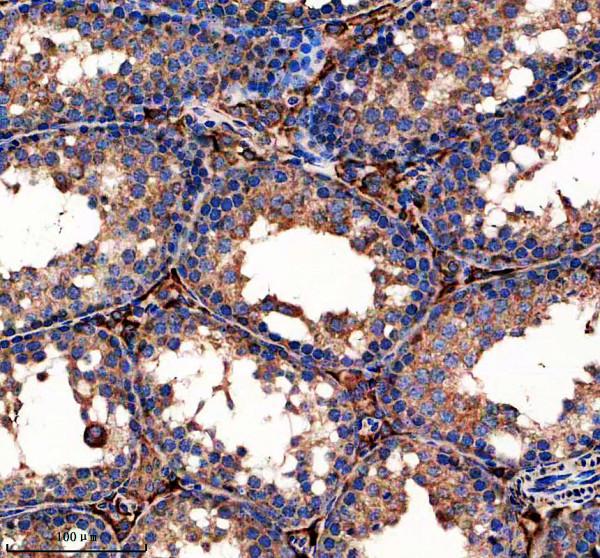 a07629 1 limd1 primary antibodies ihc testing 3