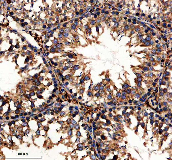 a07629 1 limd1 primary antibodies ihc testing 4