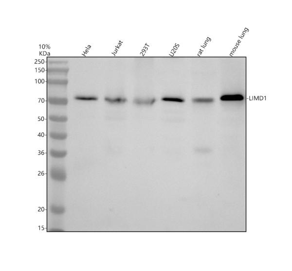 Western blot analysis of LIMD1 using anti-LIMD1 antibody (A07629-1)
