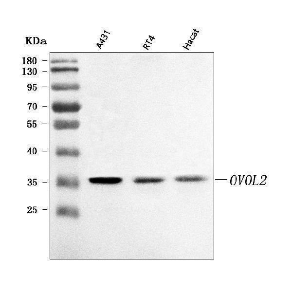  Western blot analysis of OVOL2 using anti-OVOL2 antibody (A07631-2)
