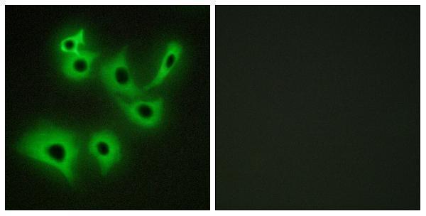 Immunofluorescence analysis of A549 cells, using CDH4 Antibody
